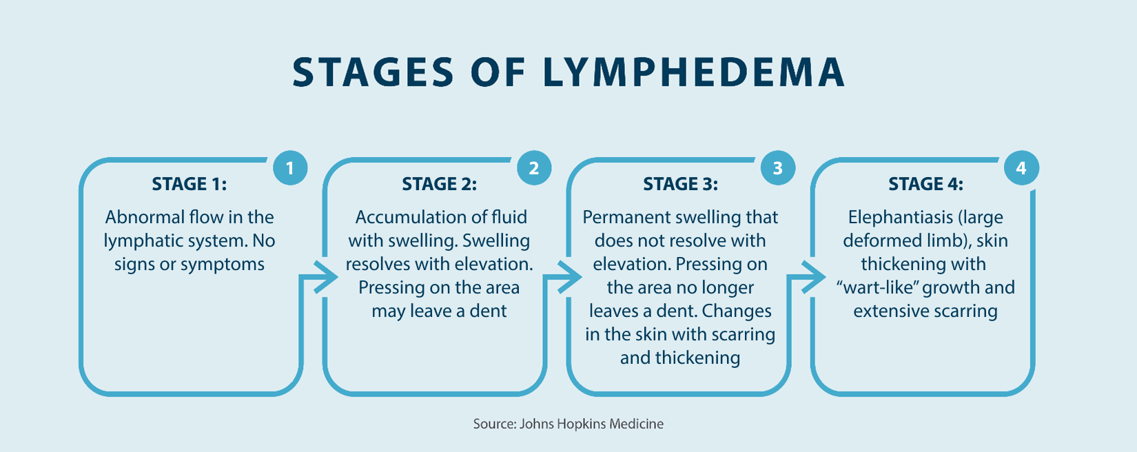 Stage 1: Abnormal flow in the lymphatic system. No signs or symptoms; Stage 2: Accumulation of fluid with swelling. Swelling resolves with elevation. Pressing on the area may leave a dent; Stage 3: Permanent swelling that does not resolve with elevation. Pressing on the area no longer leaves a dent. Changes in the skin with scarring and thickening; Stage 4: Elephantiasis (large deformed limb), skin thickening with “wart-like” growth and extensive scarring Source John Hopkins Medicine