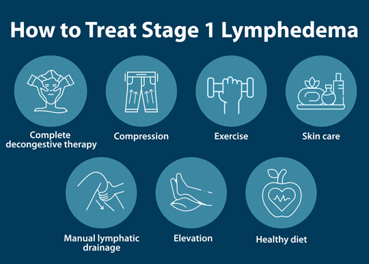 How to Treat Stage 1 Lymphedema Complete decongestive therapy Compression Exercise Skin care Manual lymphatic drainage Elevation healthy diet
